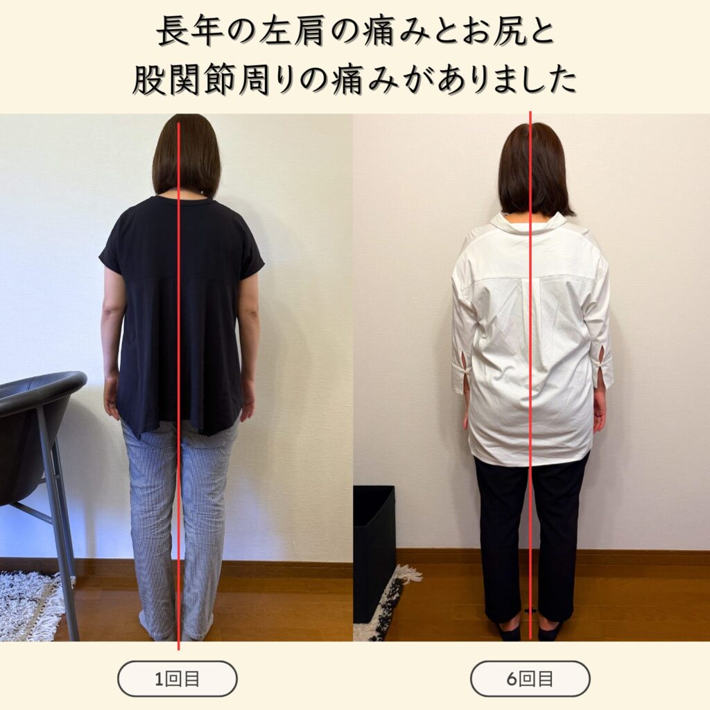 背中にファスナーのある服の着替えが楽になり、足は股関節の詰まりがなくなったのでズボンに足を入れるのがラクラクで嬉しいです