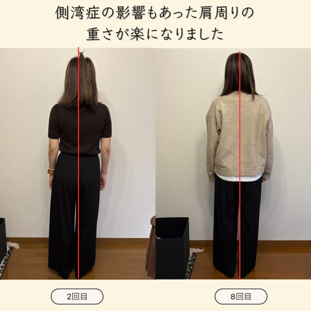側湾症の影響でバランスが悪く右肩甲骨・肩・首筋の痛み・腰痛などで辛い思いをしてきました。施術を受けてから動きやすく生活がしやすくなりました！