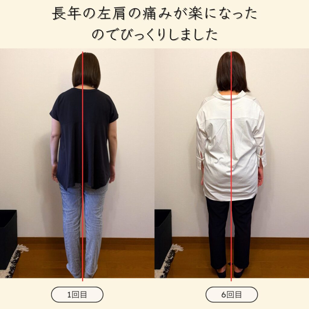 背中にファスナーのある服の着替えが楽になり、足は股関節の詰まりがなくなったのでズボンに足を入れるのがラクラクで嬉しいです