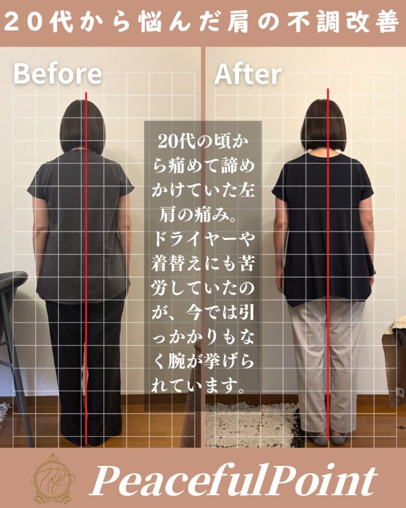 20年来の左肩の痛みは諦めていました。
ドライヤーを使う時や背中にファスナーのある服を着替えるような時に、いつも肩をかばっていました。それが、通う度に改善していき、今では日常生活に支障がなくなり嬉しいです！