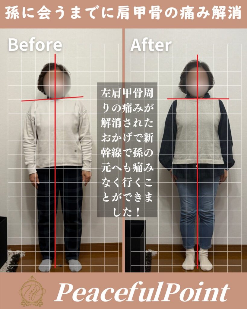 庭のお手入れを頑張りすぎて急に肩甲骨あたりに今までにない痛みが出た時に通いました。１ヶ月後に孫の元に遊びに行く予定があったので、心配でしたが、おかげでそれまでに痛みもなくなり無事孫とも会うことができました。
