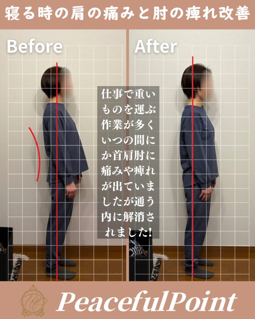 力仕事の影響でいつも肩が凝っていて、首から来るような慢性的な手の痺れにも悩み、寝る時が結構辛かったです。でもおかげさまで、今は痛みや痺れもなく過ごせています。