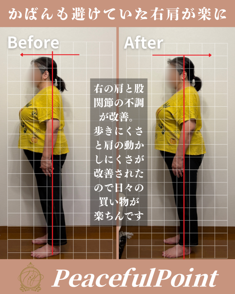 右肩の痛みと右股関節の痛みがあって日常の買い物に不安がありましたが、肩の痛みと股関節の詰まった感じが楽になったので、近所へ買い物に行くのも楽ちんになりました。
